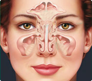 Stirnhöhlen-Entzündung (Sinusitis)