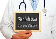 Gürtelrose Gürtelrose