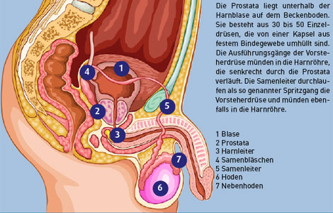 Die Prostata der Krebs die Impotenz