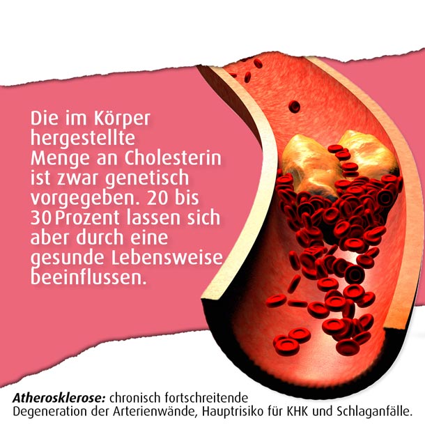 Grafik Cholesterin