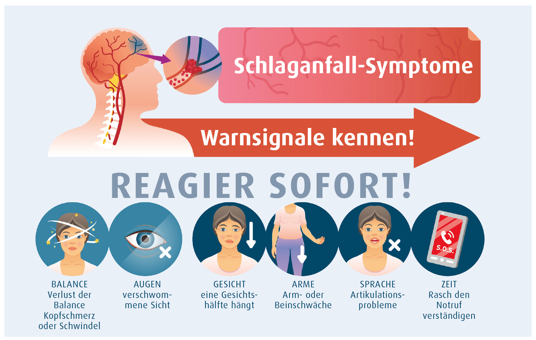 5 wichtige Schlaganfall-Symptome (Foto: Gesundheits-Nachrichten, Juni 2023) Schlaganfall Symptome