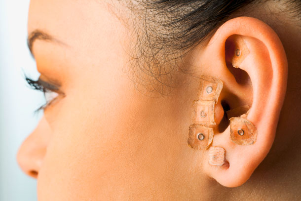 Certains points de l'oreille sont connectés aux organes et à d'autres points importants du corps.