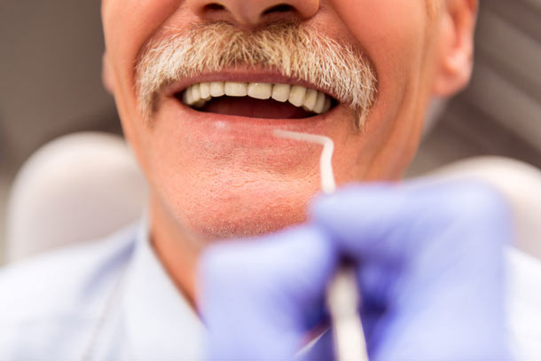 Mann zeigt Zähne beim Zahnarzt