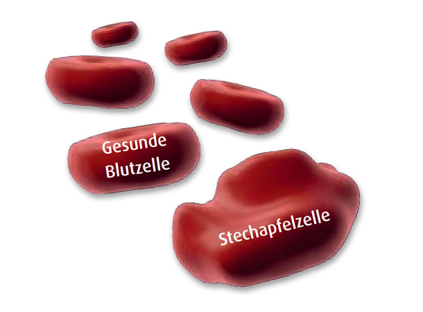 Stechapfelzellen